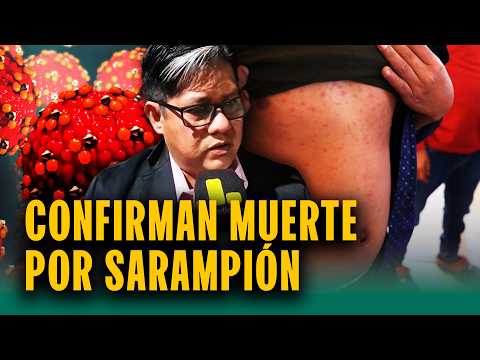 'Su religión rechaza atención de salud': Adolescente muere por sarampión en Iquitos