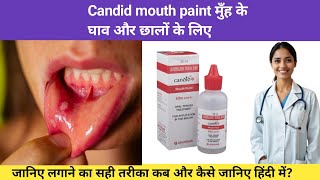 Candid mouth paint how to apply | clotrimazole mouth paint kaise lagaye |