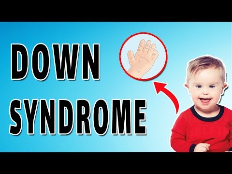 download lagu mp3 mp4 Down Syndrome Mnemonic, download lagu Down Syndrome Mnemonic gratis, unduh video klip Down Syndrome Mnemonic