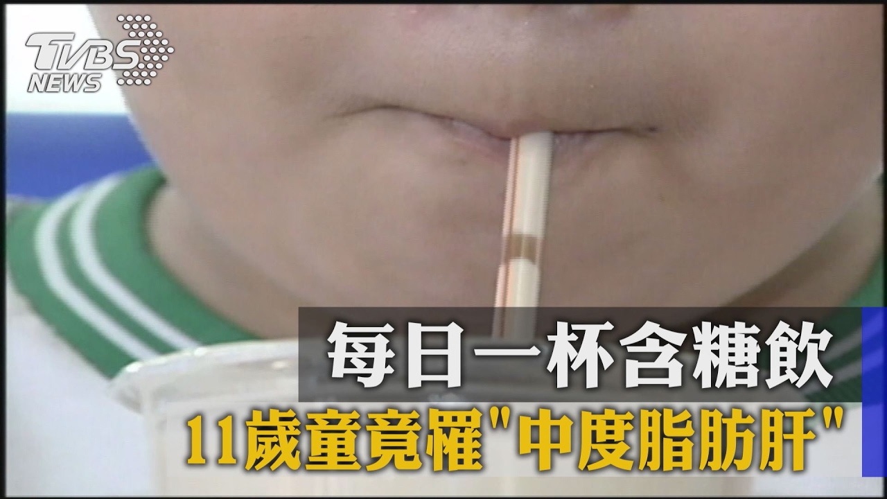 每日一杯含糖飲 11歲童竟罹「中度脂肪肝」