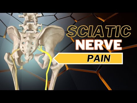 Top 3 Causes of Sciatic Nerve Pain: How to Tell What is Causing It.