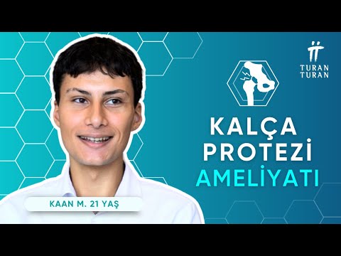 Overcoming Misdiagnosis and Restoring Mobility – Total Hip Replacement in Turkey