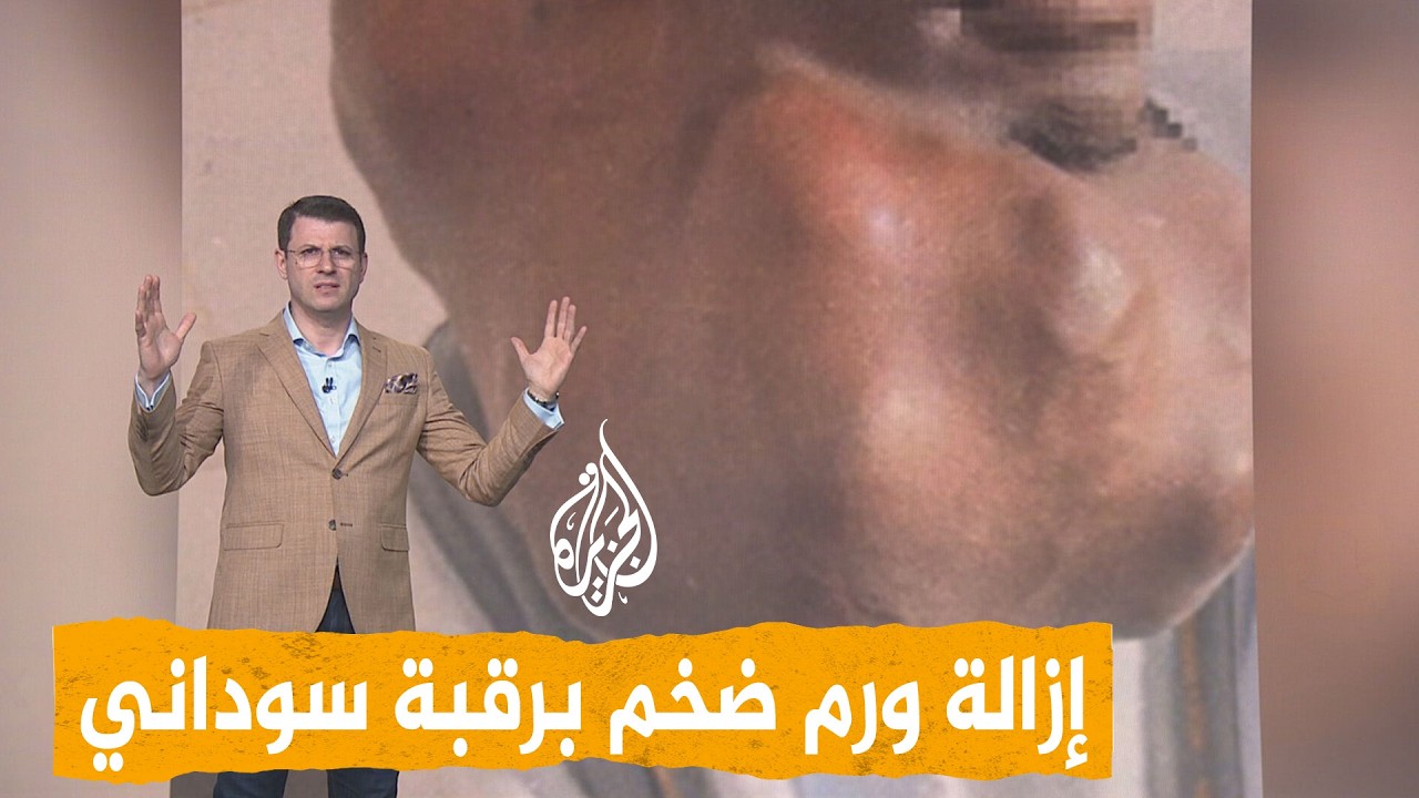 شبكات | ورم كبير في رقبة سوداني.. ماذا قال لشبكات ؟