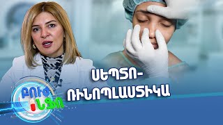 Բուժ ինֆո/ Խորհուրդ մասնագետից / Սեպտորինոպլաստիկա / Buj Info
