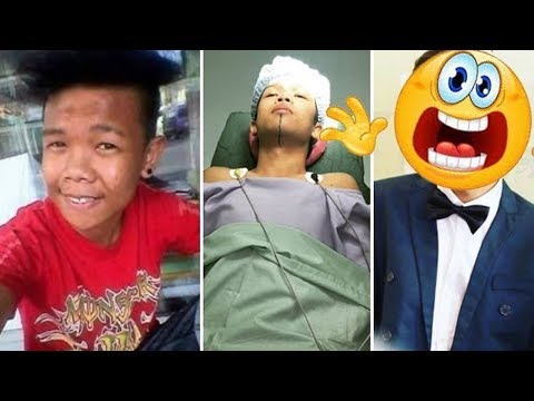Operasi penis Obat yang meningkatkan potensi