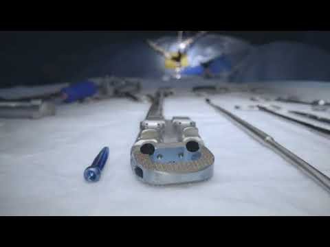 Globus Medical: Excelsius Lateral 360 Lateral ALIF 360p