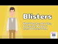 Blisters - What They Are, How they Are Caused, & How to Treat & Prevent Them