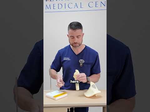 Hip Replacement Surgery Video
