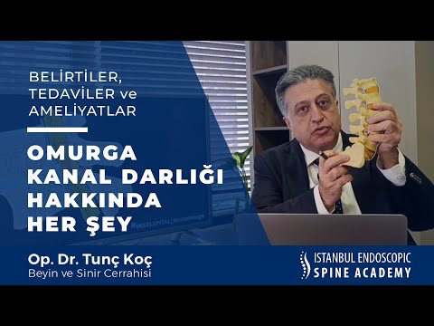 Omurga Kanalı Darlığı Hakkında Her Şey