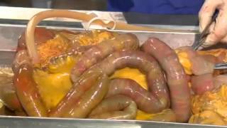 Autopsy - Life and Death - Poisoning [3]