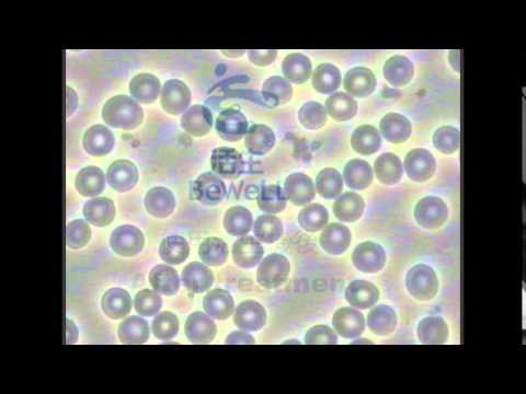 CCC0150081 @2015.09.24 before/after photos