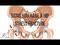 Femoral neck stress fracture: Signs, symptoms, diagnosis, and treatment
