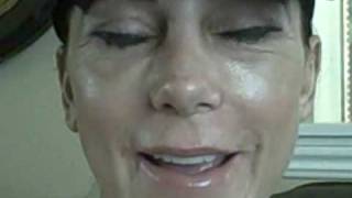 My Facial Plastic Surgery Blog – Recovery Day 16