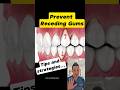 Prevent Receding Gums: 3 Easy Habits for Better Oral Health #dentallan #dentist #shorts