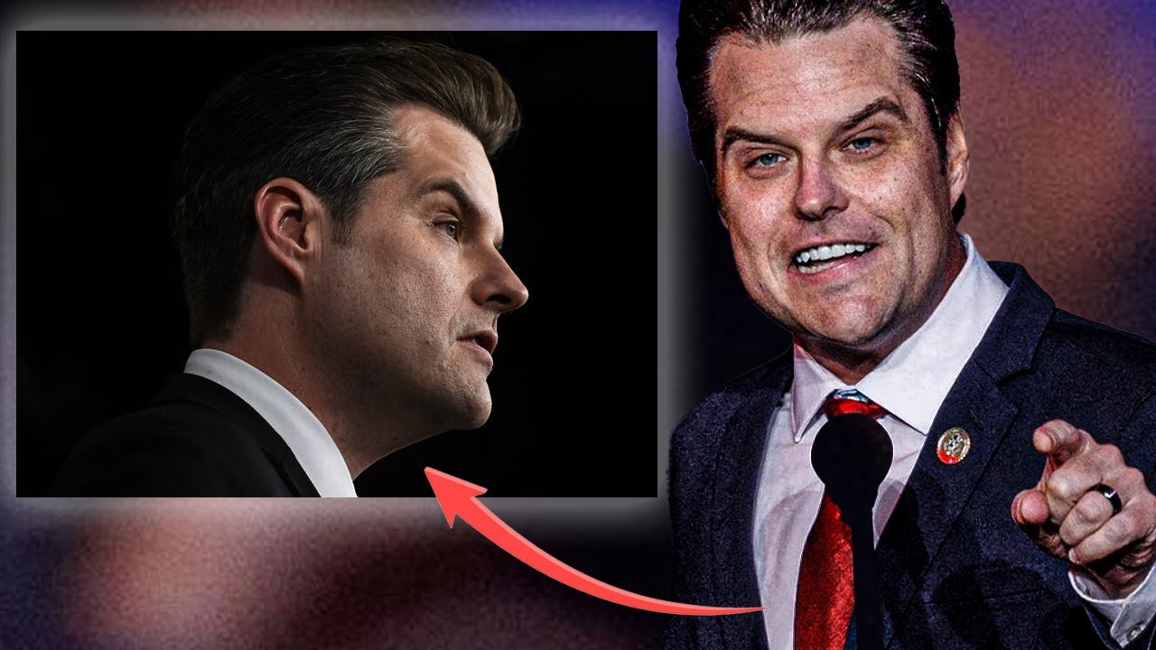 Plastic Surgeon Reveals What Happened to Matt Gaetz’s Face