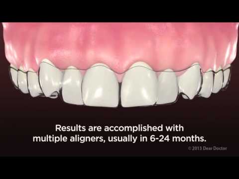 download lagu mp3 mp4 Clear Path Aligners, download lagu Clear Path Aligners gratis, unduh video klip Clear Path Aligners