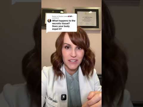 What happens to fat necrosis?