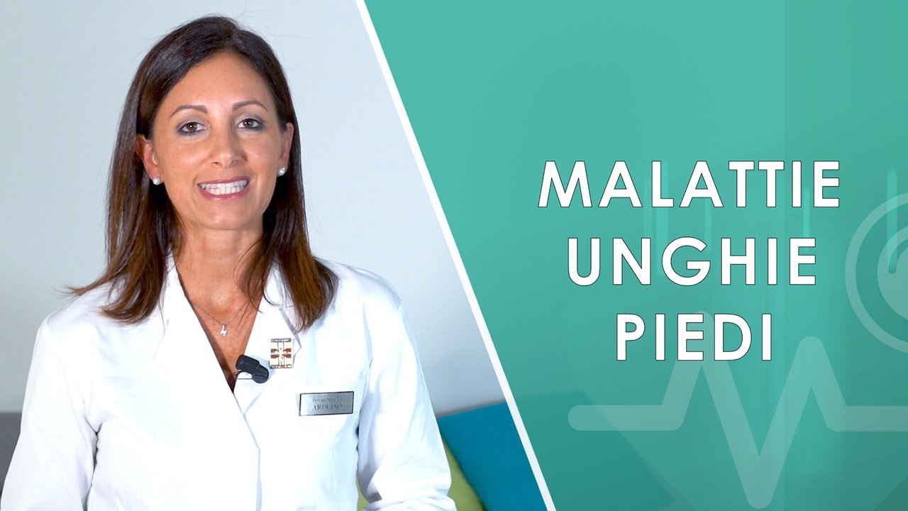 Cosa si nasconde dietro a delle brutte unghie