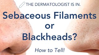 Dermatologist Explains: Sebaceous Filaments vs Blackheads