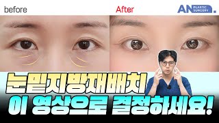 유튜브