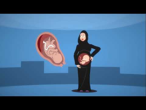 Pregnant women and high blood pressure