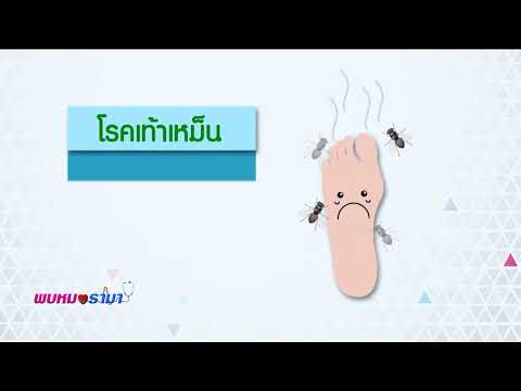 โรคสะเก็ดเงินกับอาการหนังศีรษะ Ankylosing spondylitis, โรคสะเก็ดเงิน