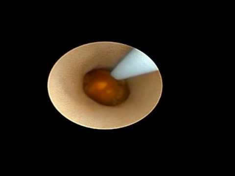 Recensioni massaggio prostatico di medici Massager recensioni prostata