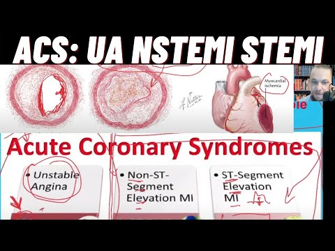 ACS Acute Coronary Syndromes, UA, NSTEMI, STEMI, Treatment Aspirin, Nitroglycerin, Oxygen EMT-B