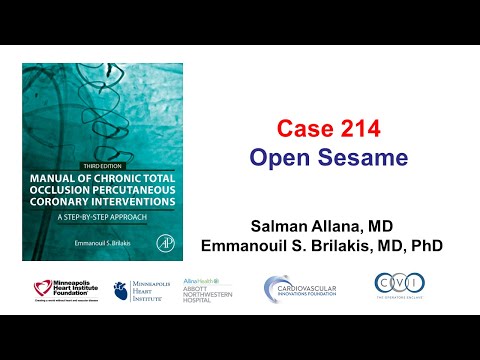 Case 214: Manual of CTO PCI - open sesame