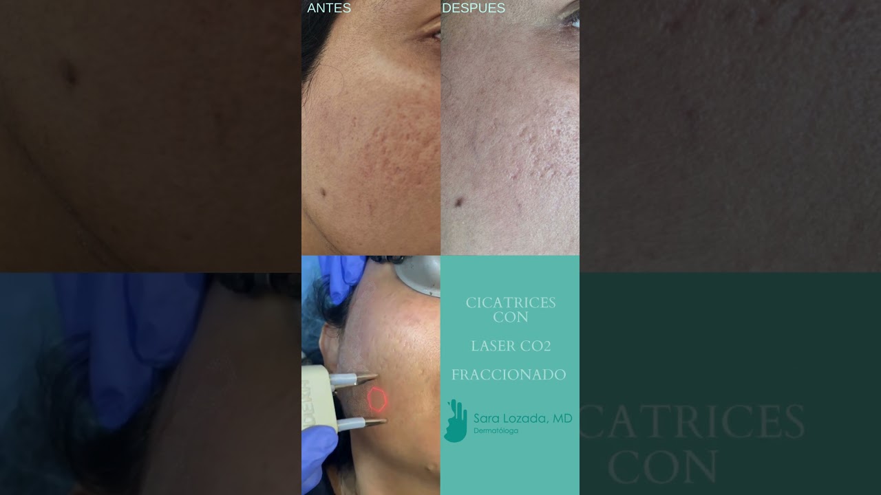 Sara Maria Lozada Ordoñez-7