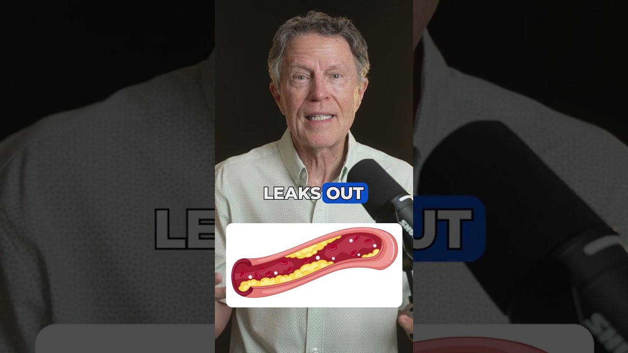 The Most Dangerous Type of Arterial Plaque