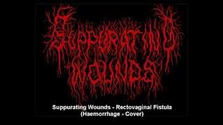 SUPPURATING WOUNDS - Rectovaginal Fistula - (Haemorrhage - cover)