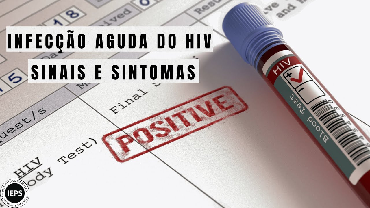 INFECÇÃO AGUDA DO HIV. SINAIS E SINTOMAS