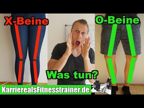 Was ist nejrodermit und die Schuppenflechte Disgidrotitscheskaja das Ekzem der Hände der Hände die Salbe