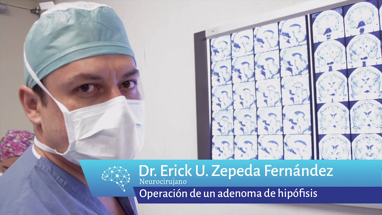 Erick Ulises Zepeda Fernández-28