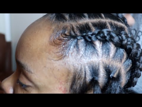 download lagu mp3 mp4 Stitch Braids With Rubber Bands, download lagu Stitch Braids With Rubber Bands gratis, unduh video klip Download Stitch Braids With Rubber Bands Mp3 dan Mp4 Viral Gratis