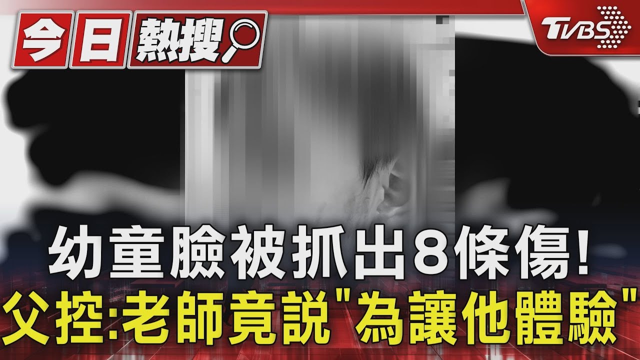 幼童臉被抓出8條傷痕！父控：老師竟說「為讓他體驗」
