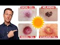 Getting Vitamin D From The Sun WITHOUT The Skin Cancer