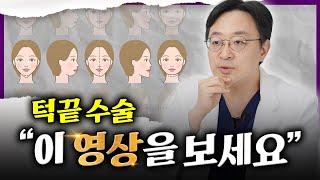 턱끝수술을 5분 만에 요약해드림!