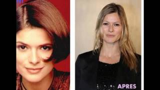 Avant / Après : les acteurs d'Hélène et les garçons ont bien changé !