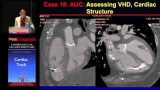 Download Lagu CT (John Mahmarian, MD) Thumbnail