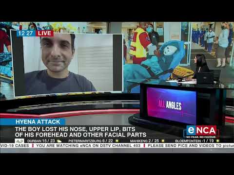 Hyena attack | Boy who was mauled receives plastic surgery