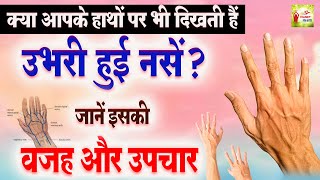Download lagu क्या आपके हाथों में भी दिखती है उभरी हुई नसें जानें इसकी वजह और उपचार | Hands Veins | Health Tips mp3