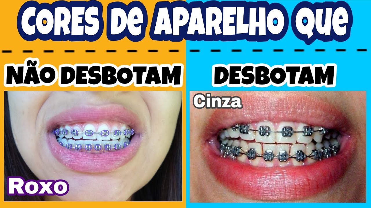 CORES DE APARELHO Que NÃO DESBOTAM e DESBOTAM !!! (Minha opinião e dica)