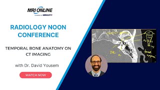Download lagu Temporal Bone Anatomy on CT Imaging w/ Dr. David Yousem - Medality (MRI Online) Radiology Conference mp3