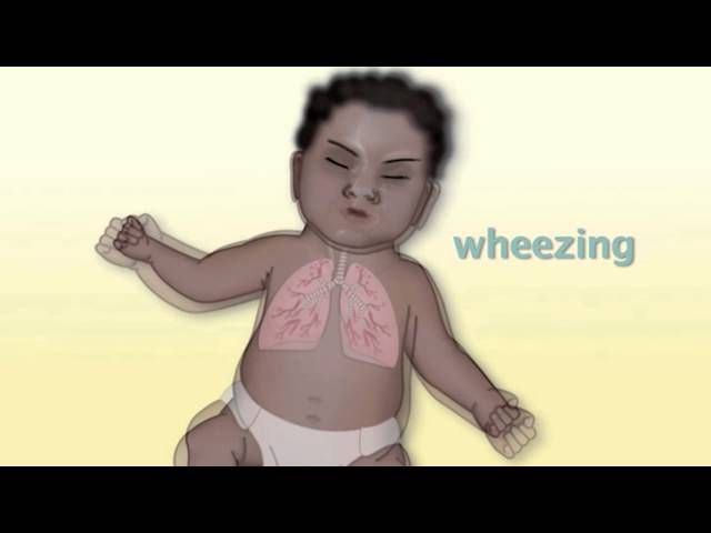 Video Pronunciation of stertor in English Video Pronunciation of stertor in English