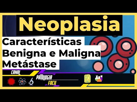 Neoplasias Benignas e Malignas - Características ; Metástase (Patologia Geral) [Atualizado 2022]