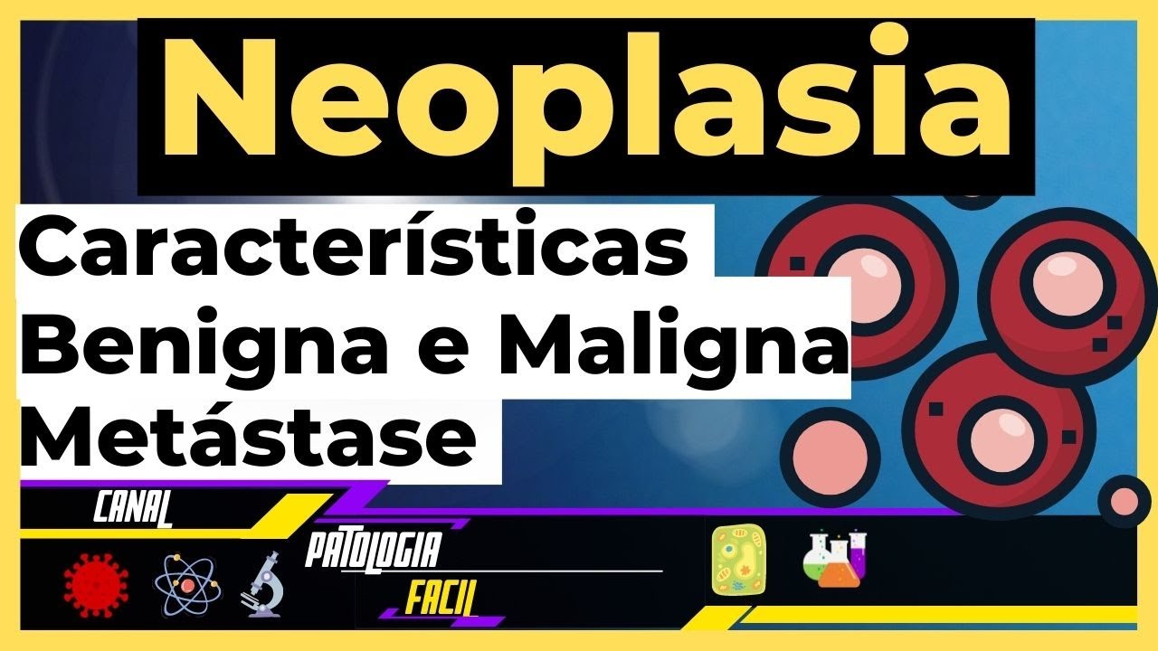 Neoplasias Benignas e Malignas - Características ; Metástase (Patologia Geral) [Atualizado 2022]