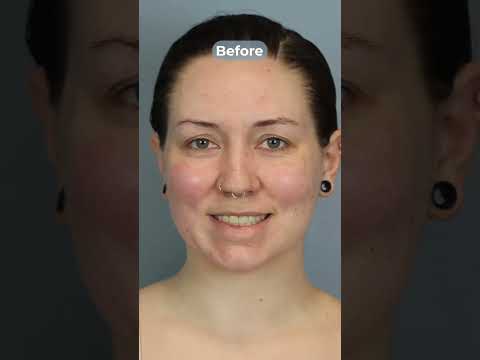 Leong Plastic Surgery NYC