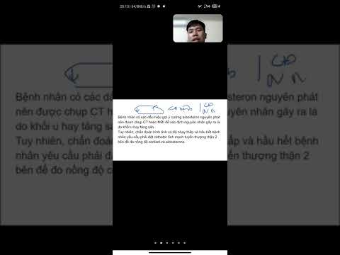 Cường Aldosterona-H/c Conn p2